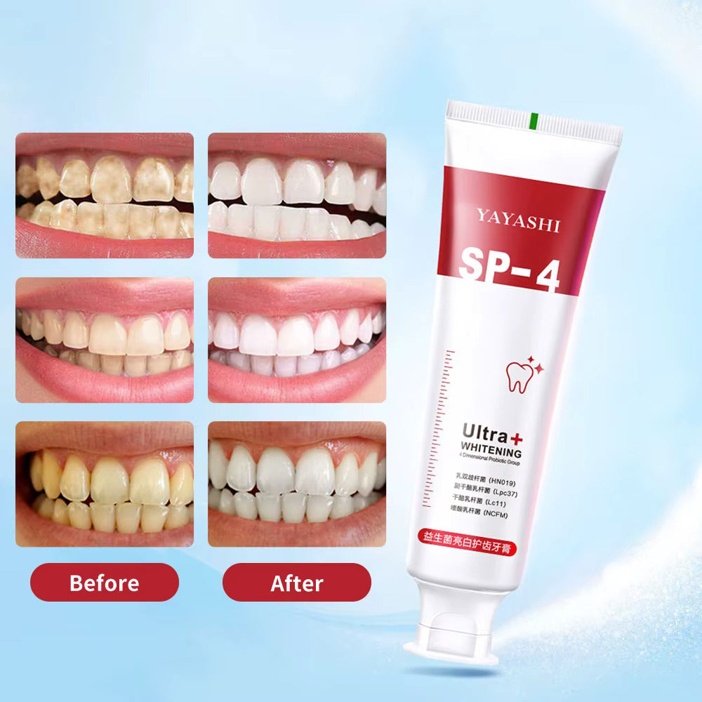 Last Day Of Discount 🔥 SP4 Probiotic Whitening Toothpaste